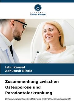 portada Zusammenhang zwischen Osteoporose und Parodontalerkrankung (en Alemán)