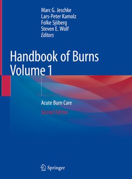 portada Handbook of Burns Volume 1: Acute Burn Care
