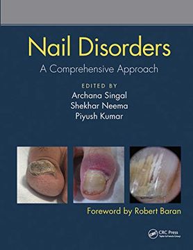 portada Nail Disorders: A Comprehensive Approach 