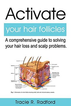 portada Activate Your Hair Follicles: A Comprehensive Guide to Solving Your Hair Loss and Scalp Problems (en Inglés)