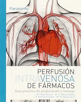 Perfusión Intravenosa De Fármacos