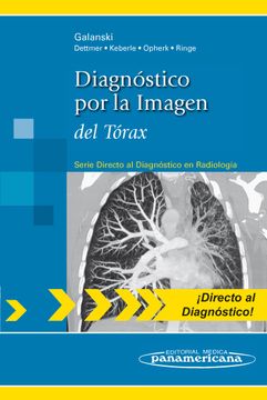 portada Diagnóstico por la Imagen del Tórax. (Serie Directo al Diagnóstico en Radiología) (in Spanish)