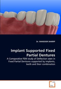 portada implant supported fixed partial dentures (en Inglés)