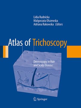 Atlas of Trichoscopy: Dermoscopy in Hair and Scalp Disease (en Inglés)