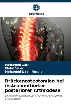 portada Brückenosteotomien bei instrumentierter posteriorer Arthrodese (en Alemán)