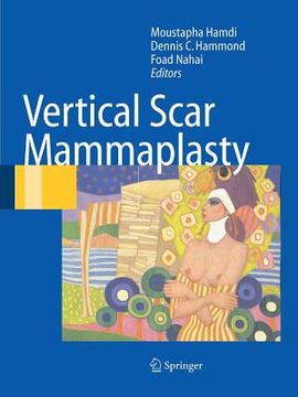 portada vertical scar mammaplasty