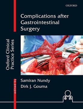 portada Complications After Gastrointestinal Surgery (Oxford Clinical Practice Series) (en Inglés)