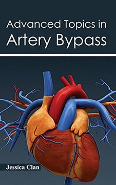 portada Advanced Topics in Artery Bypass