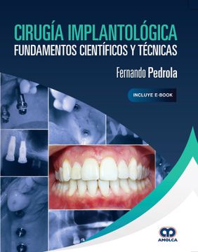 portada Cirugia Implantologica. Fundamentos Cientificos y Tecnicas (Incluye E-Book)