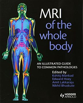 portada MRI of the Whole Body: An Illustrated Guide for Common Pathologies (in English)