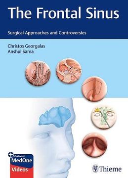 portada The Frontal Sinus: Surgical Approaches and Controversies (en Inglés)