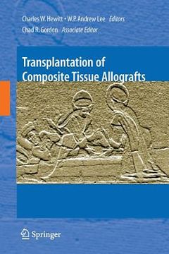 portada Transplantation of Composite Tissue Allografts