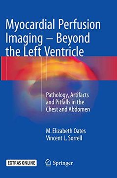 portada Myocardial Perfusion Imaging - Beyond the Left Ventricle: Pathology, Artifacts and Pitfalls in the Chest and Abdomen (in English)