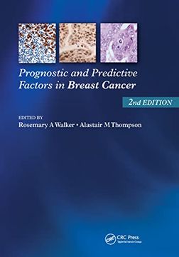 portada Prognostic and Predictive Factors in Breast Cancer (en Inglés)