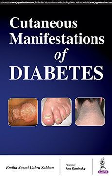 portada Cutaneous Manifestations of Diabetes