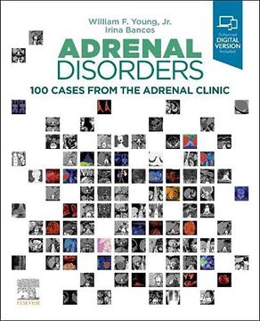 portada Adrenal Disorders: 100 Cases From the Adrenal Clinic (en Inglés)
