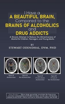 portada I Have a Beautiful Brain, Compared to the Brains of Alcoholics and Drug Addicts (en Inglés)