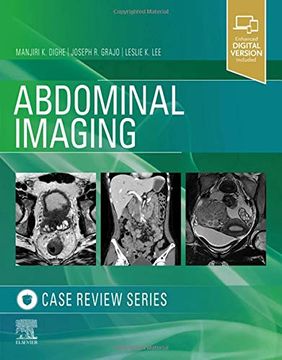 portada Abdominal Imaging: Case Review Series, 1e (en Inglés)