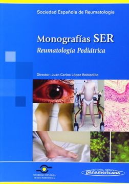 portada Monografias Ser. Reumatologia Pediatrica (in Spanish)
