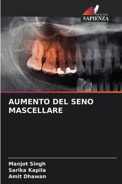 portada Aumento del Seno Mascellare (en Italiano)