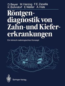 portada Rã¶Ntgendiagnostik von Zahn- und Kiefererkrankungen de Hã¼Ls; Walter; Bohndorf; Zanella; Herzog; Beyer(Springer Verlag Gmbh) (en Alemán)