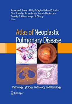 portada Atlas of Neoplastic Pulmonary Disease: Pathology, Cytology, Endoscopy and Radiology (en Inglés)