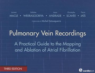 portada Pulmonary Vein Recordings: A Practical Guide to the Mapping and Ablation of Atrial Fibrillation