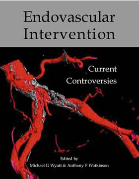 portada Endovascular Intervention: Current Controversies (en Inglés)