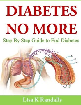 portada Diabetes no More: Step by Step Guide to end Diabetes (en Inglés)
