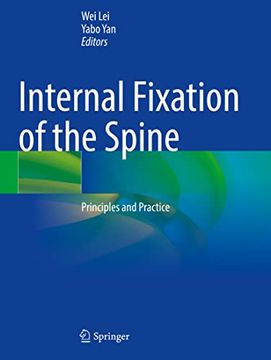 portada Internal Fixation of the Spine: Principles and Practice (en Inglés)