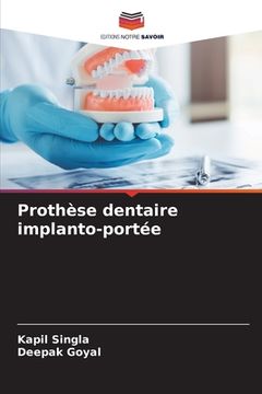portada Prothèse dentaire implanto-portée (en Francés)
