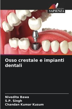 portada Osso crestale e impianti dentali (in Italian)