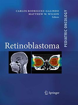 portada Retinoblastoma (Pediatric Oncology)