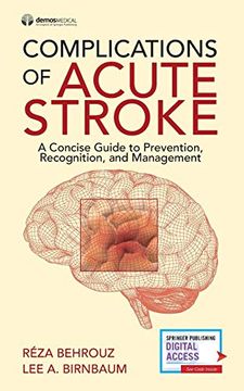 portada Complications of Acute Stroke: A Concise Guide to Prevention, Recognition, and Management (en Inglés)