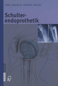 portada Schulterendoprothetik: Indikation, Implantate, Op-Technik, Nachbehandlung, Begutachtung (in German)