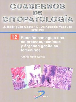 Punción con aguja fina de próstata, testículo y organos genitales femeninos: Cuadernos de citopatología-12