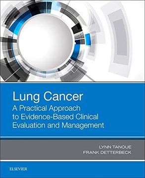 portada Lung Cancer: A Practical Approach to Evidence-Based Clinical Evaluation and Management (Hardback) (en Inglés)