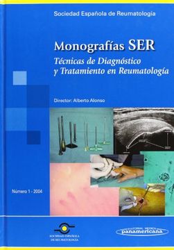 portada Monografía Ser: Técnicas de Diagnóstico y Tratamiento en Reumatología (in Spanish)