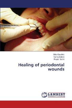 portada Healing of periodontal wounds