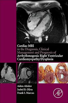 portada Cardiac mri in Diagnosis, Clinical Management, and Prognosis of Arrhythmogenic Right Ventricular Cardiomyopathy (en Inglés)