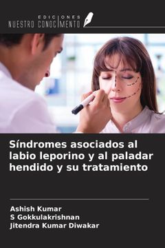 Síndromes asociados al labio leporino y al paladar hendido y su tratamiento (in Spanish)