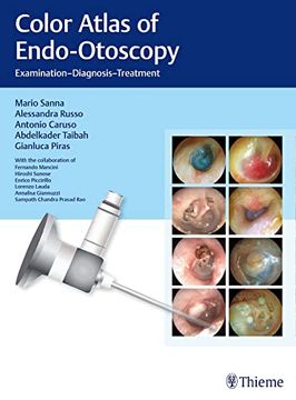portada Color Atlas of Endo-Otoscopy: Examination-Diagnosis-Treatment (en Inglés)