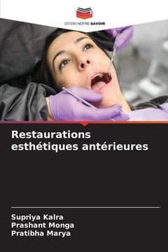 portada Restaurations esthétiques antérieures (en Francés)