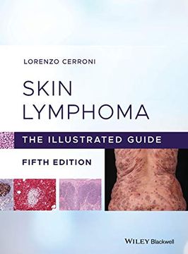 portada Skin Lymphoma: The Illustrated Guide (in English)