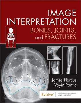 portada Image Interpretation: Bones, Joints, and Fractures (en Inglés)