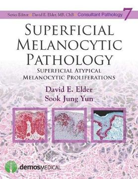 portada Superficial Melanocytic Pathology: Superficial Atypical Melanocytic Proliferations: 7 (Consultant Pathology Series) (en Inglés)