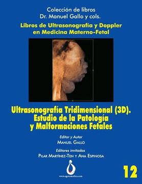 portada Ultrasonografía Tridimensional (3D). Estudio de la Patología y Malformaciones Fetales (in Spanish)