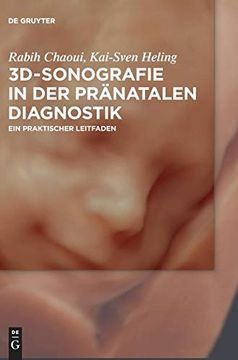 portada 3D-Sonografie in der pr Natalen Diagnostik: Ein Praktischer Leitfaden 