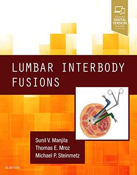 portada Lumbar Interbody Fusions (en Inglés)