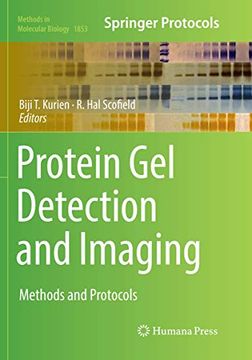 portada Protein Gel Detection and Imaging: Methods and Protocols